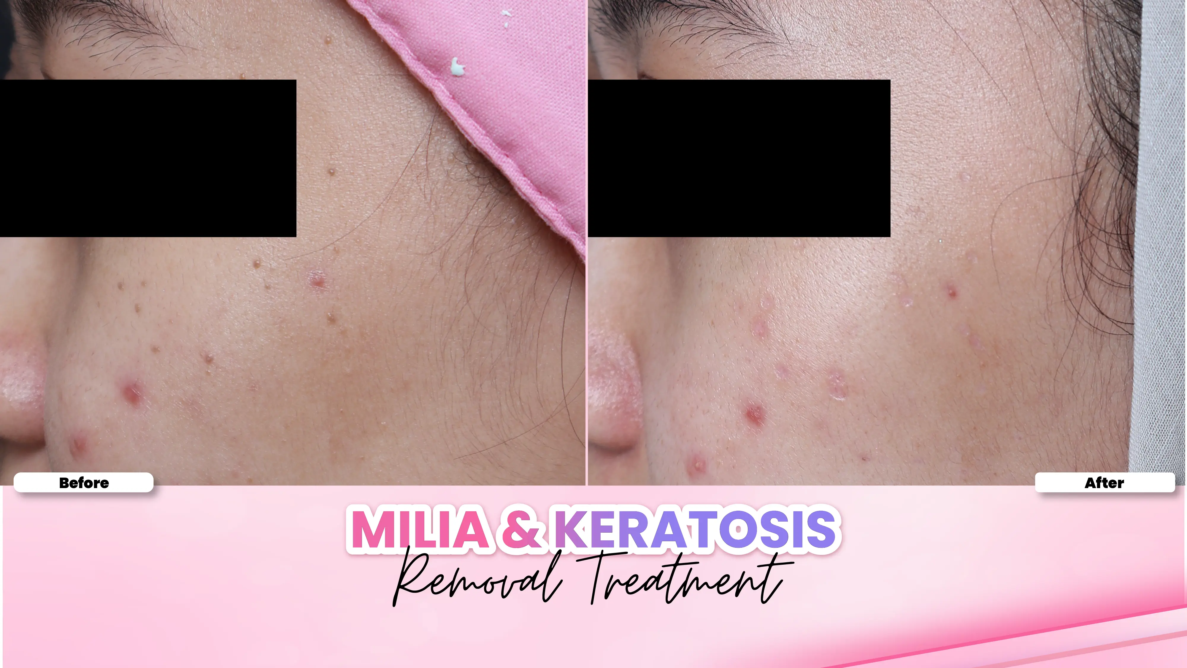 Before after treatment