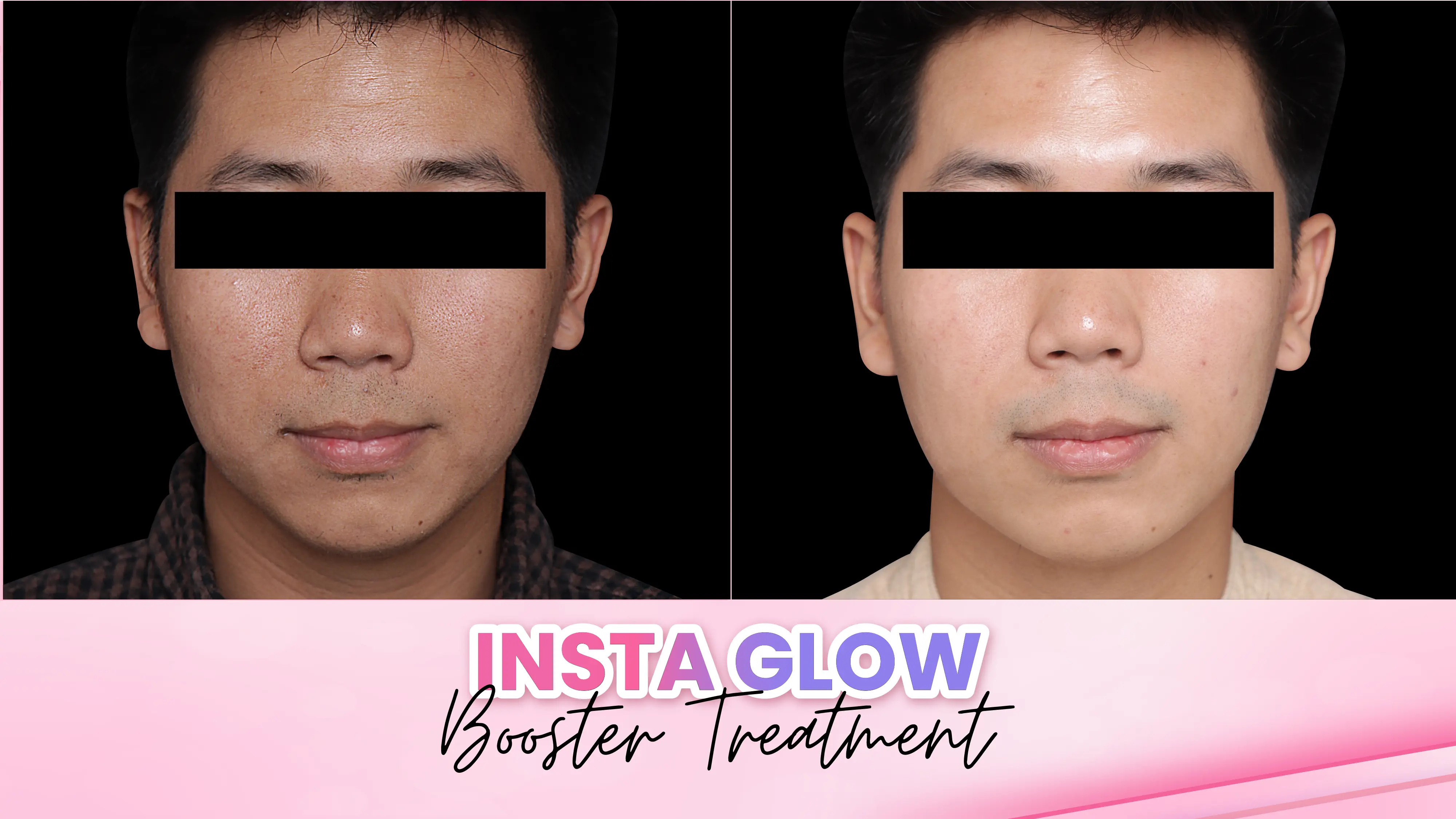Before after treatment