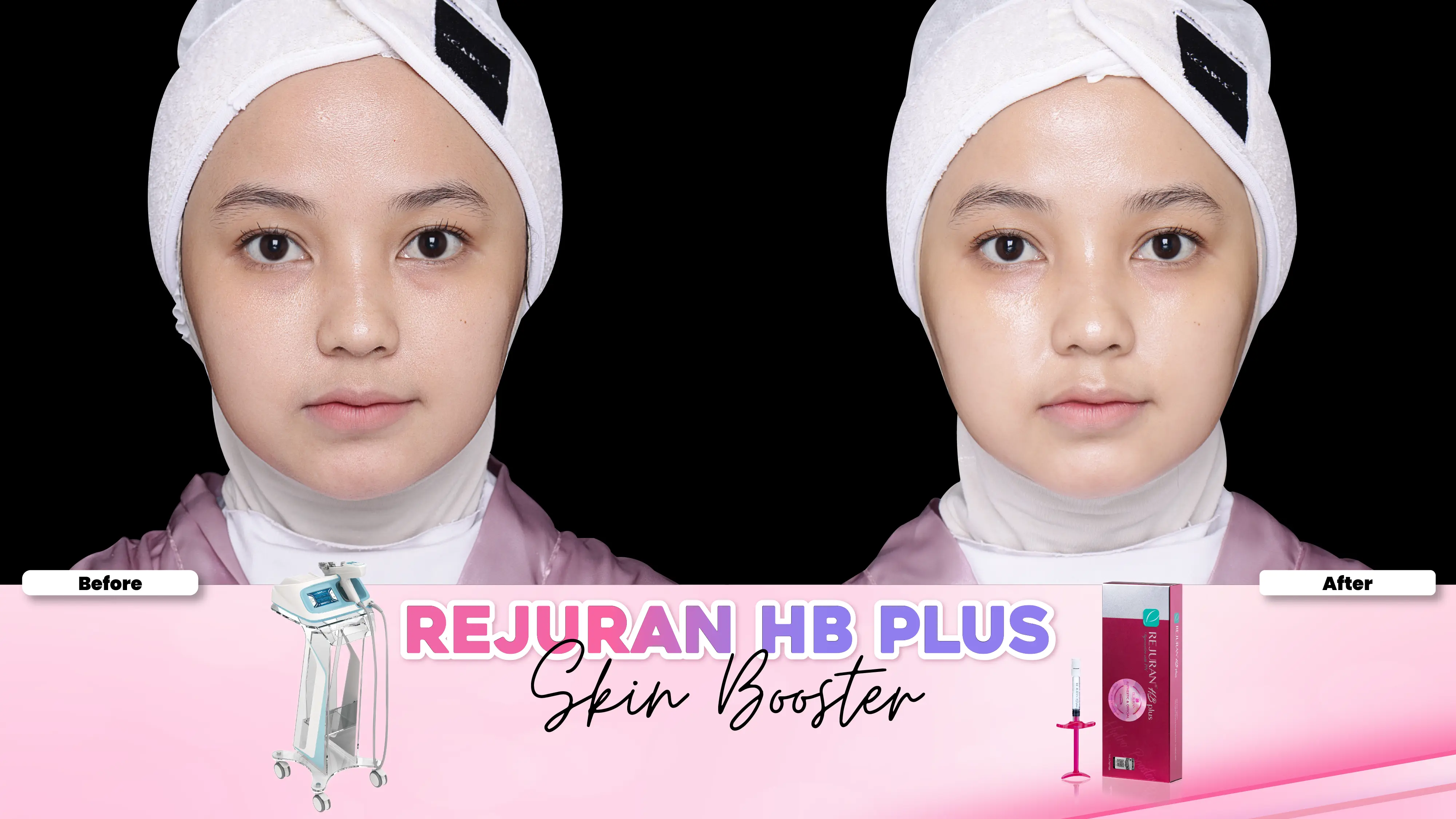 Before after treatment