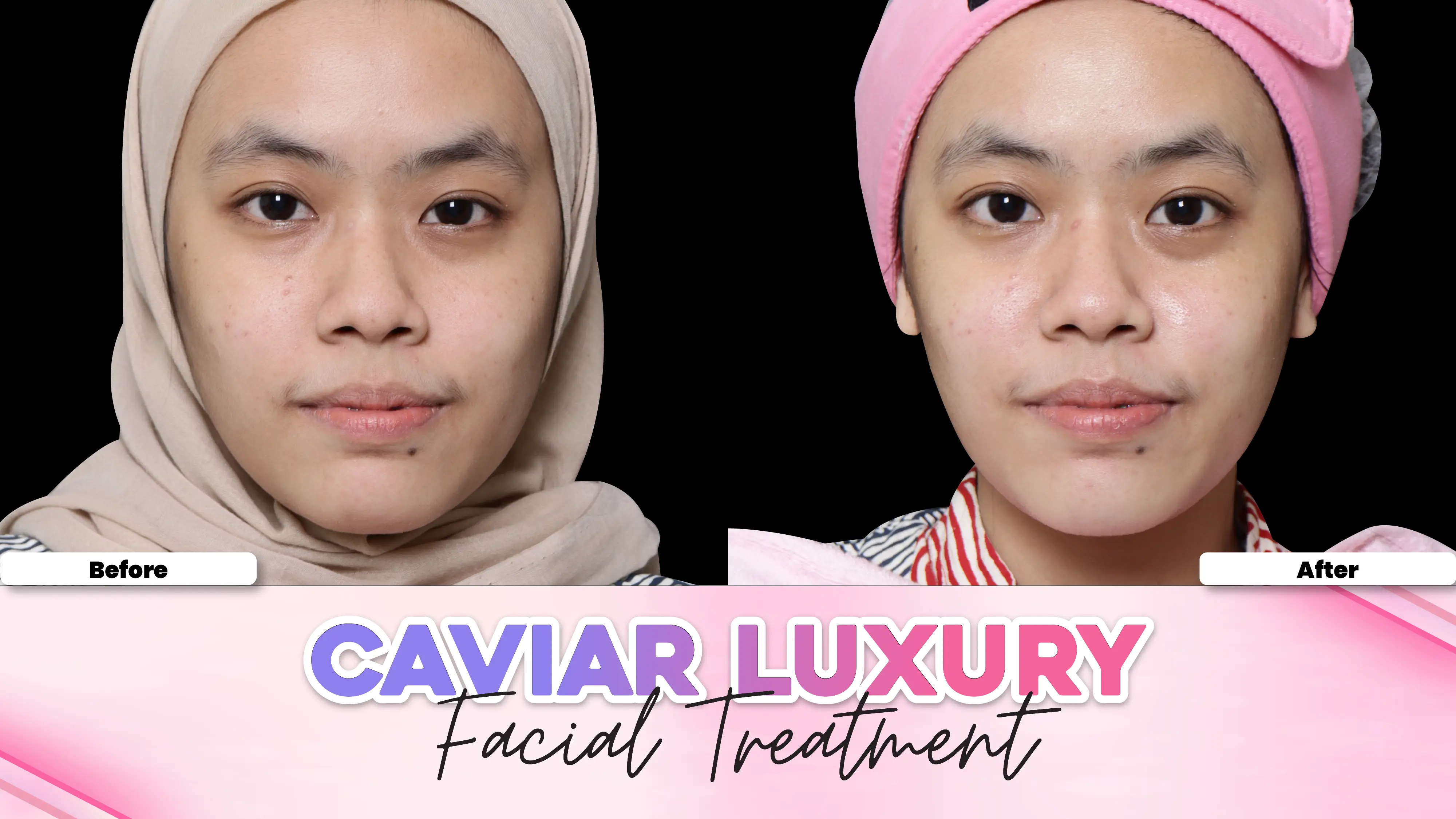 Before after treatment