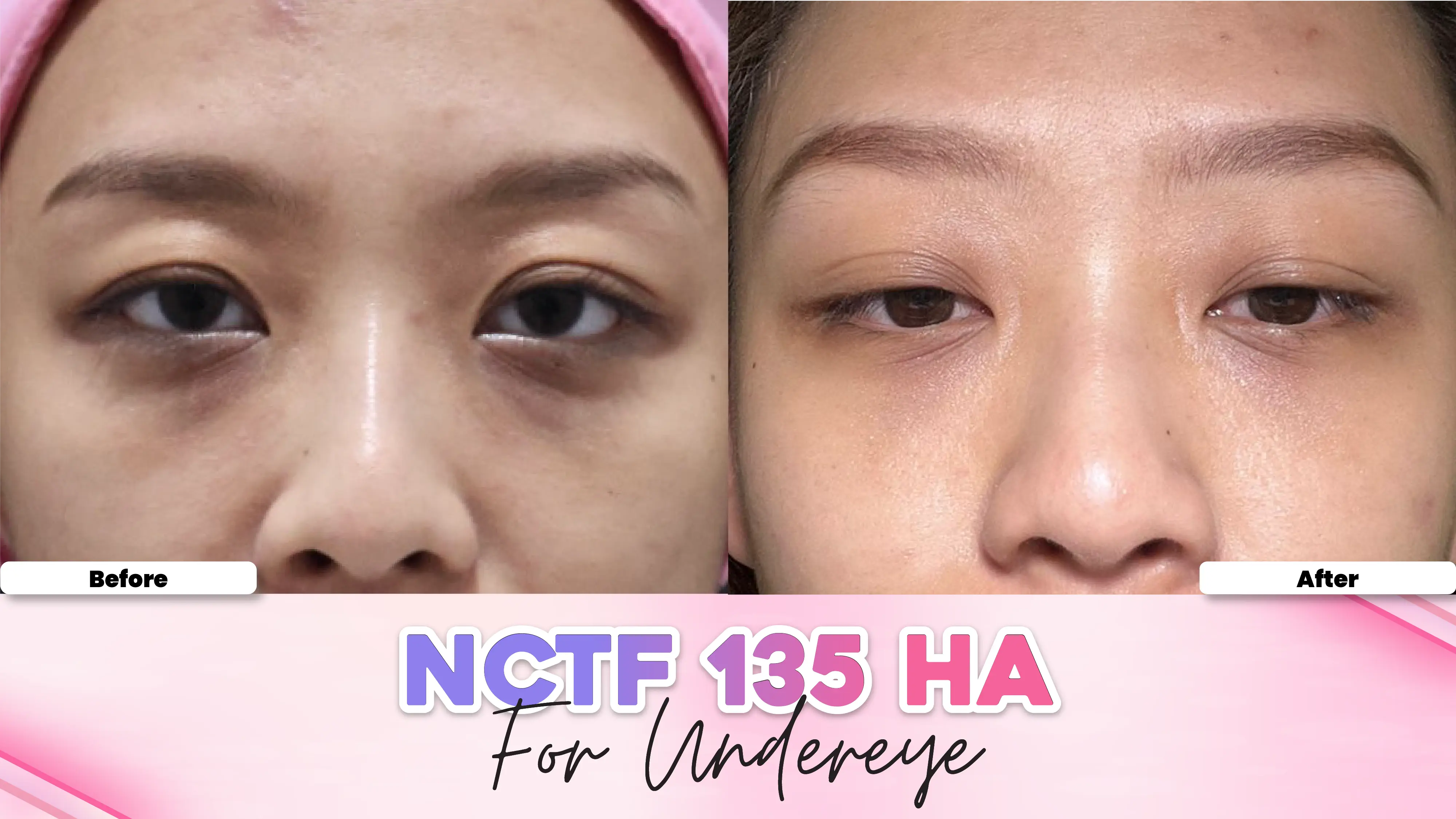Before after treatment