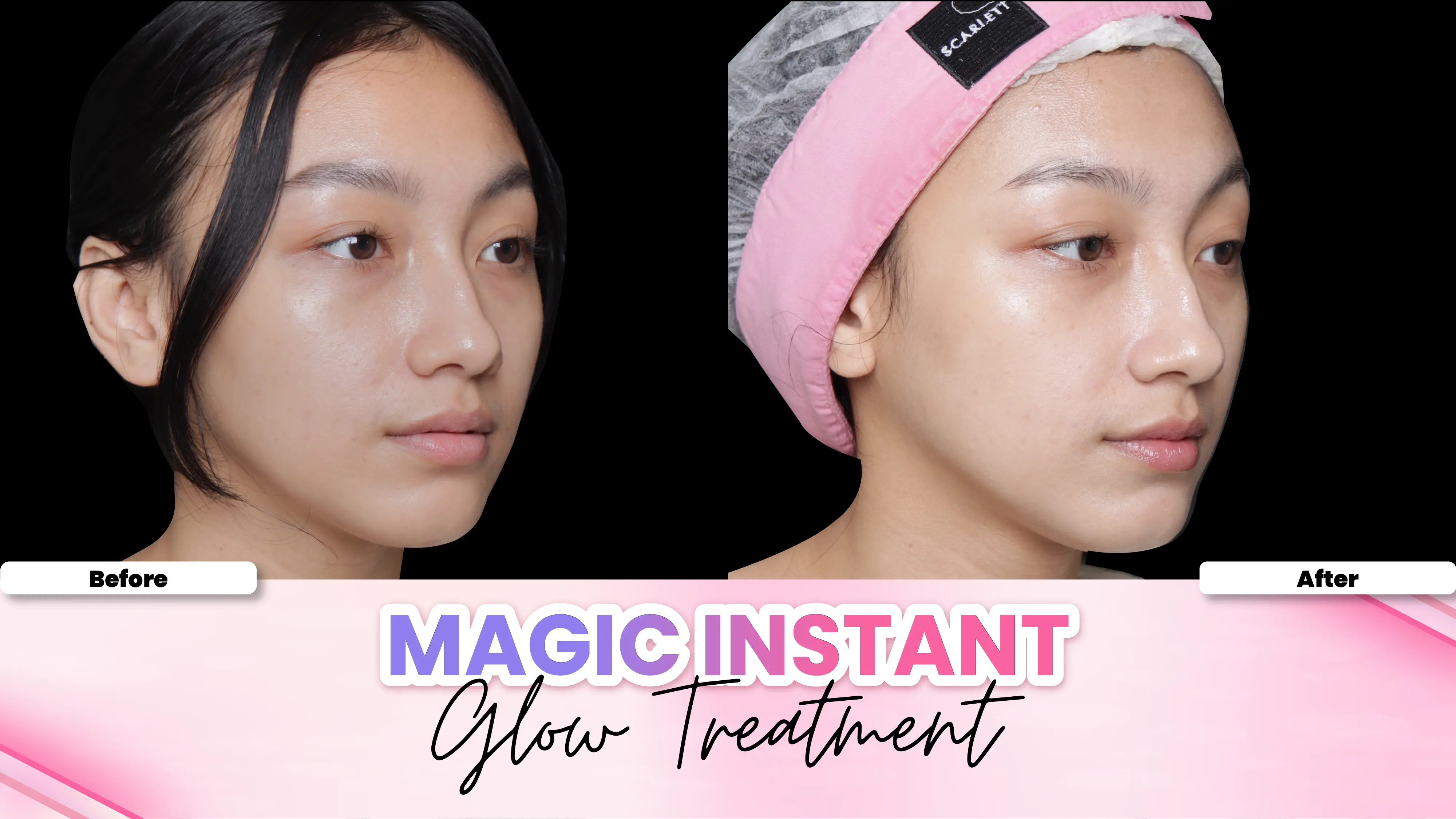 Before after treatment