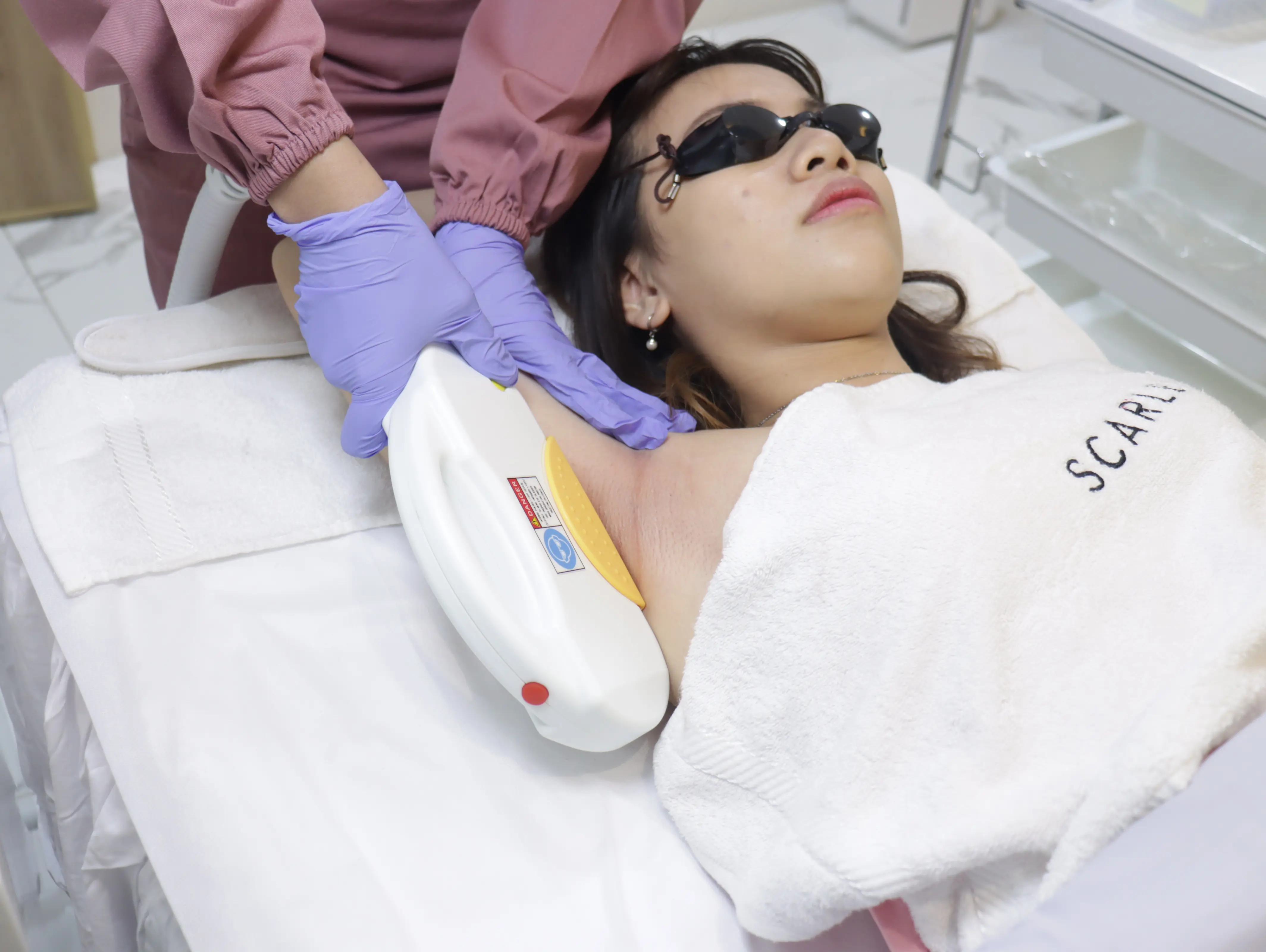Underarm Hair Removal I2PL treatment